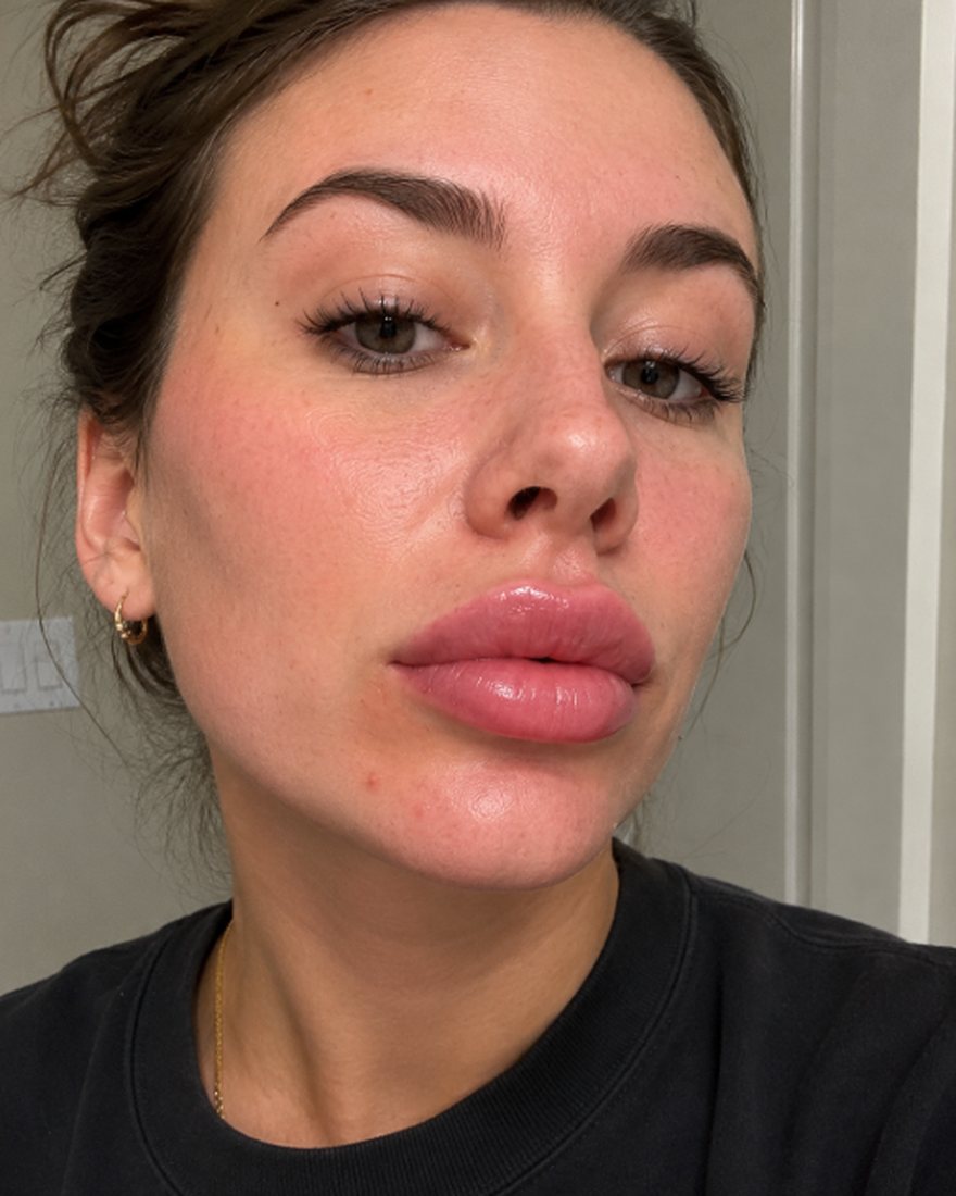 Patient-submitted recovery photo